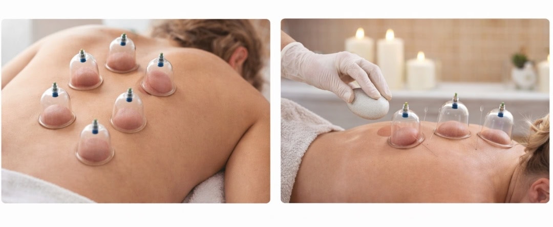 Ventouses seules ou combinées à d’autres techniques ?